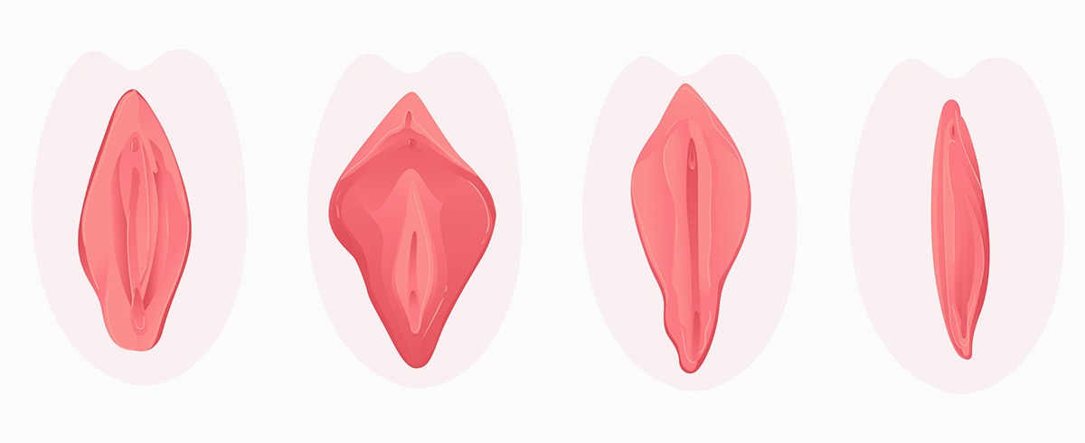 What Is A Labiaplasty in NYC