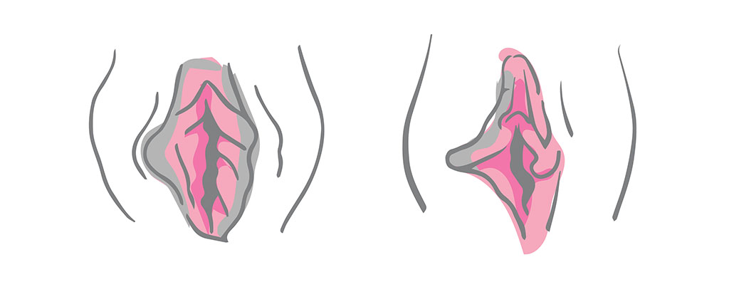 Causes of Labial Asymmetry