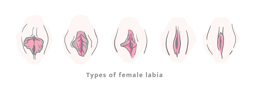 Definition and Types of Labial Asymmetry