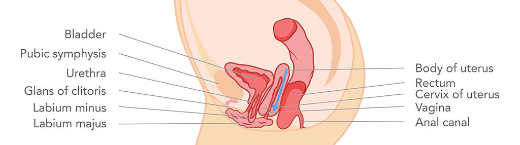 Visión general de los procedimientos y recuperación de la vagina de diseño de la perineoplastia