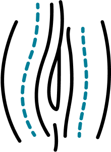 Clitoral Hood Refinement