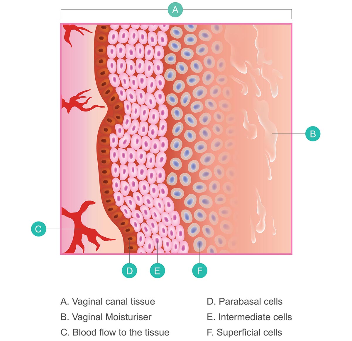 What Is Vaginal Atrophy
