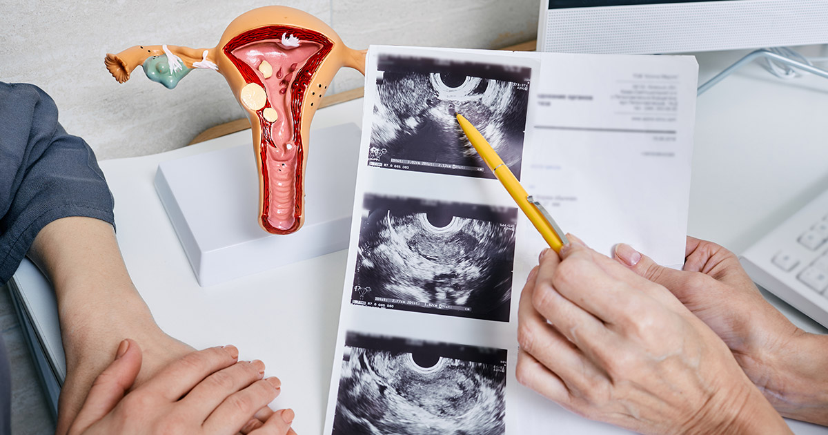 Labiaplasty While pregnant is No