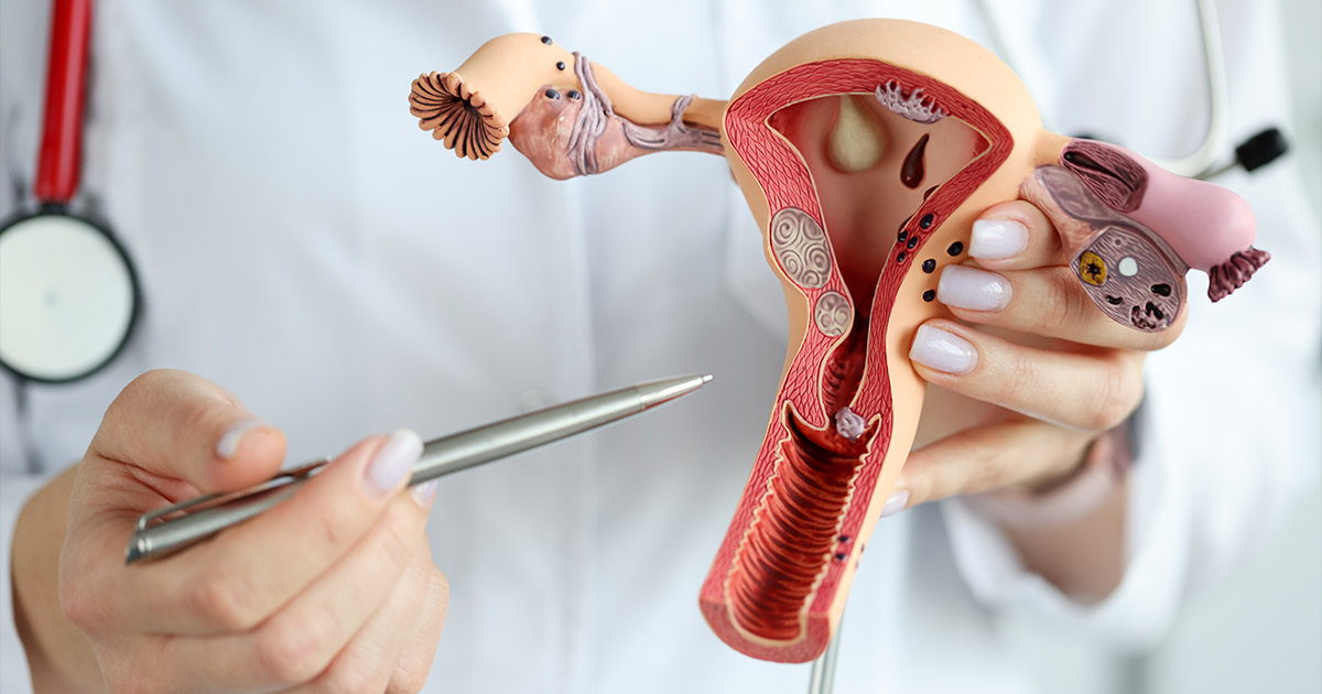 Are Vaginoplasty Results Permanent