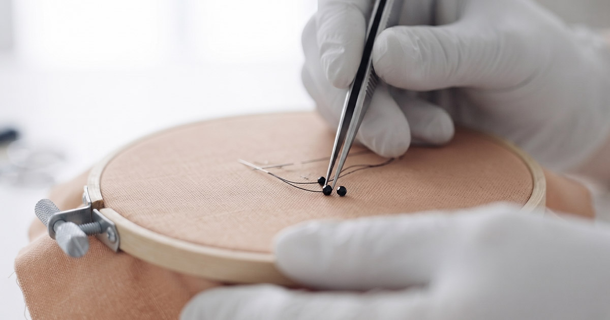 Surgical Technique and Wound Tension